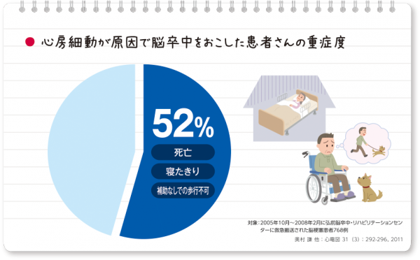 心房細動による脳梗塞の重症度:52%が死亡・寝たきり・歩行不能