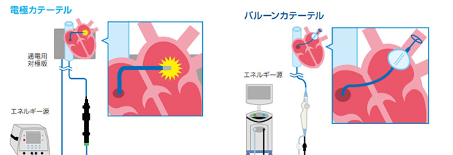 電極カテーテル、バルーンカテーテル