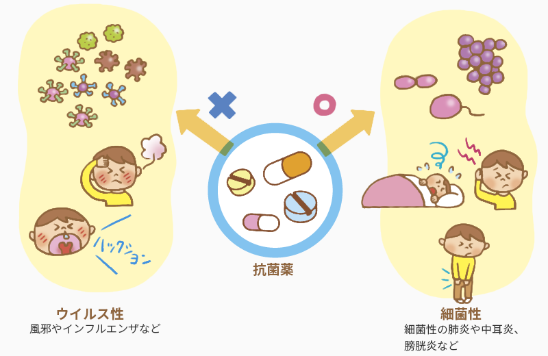 ウイルス性のかぜに抗菌薬が無効であることを示すイメージ図